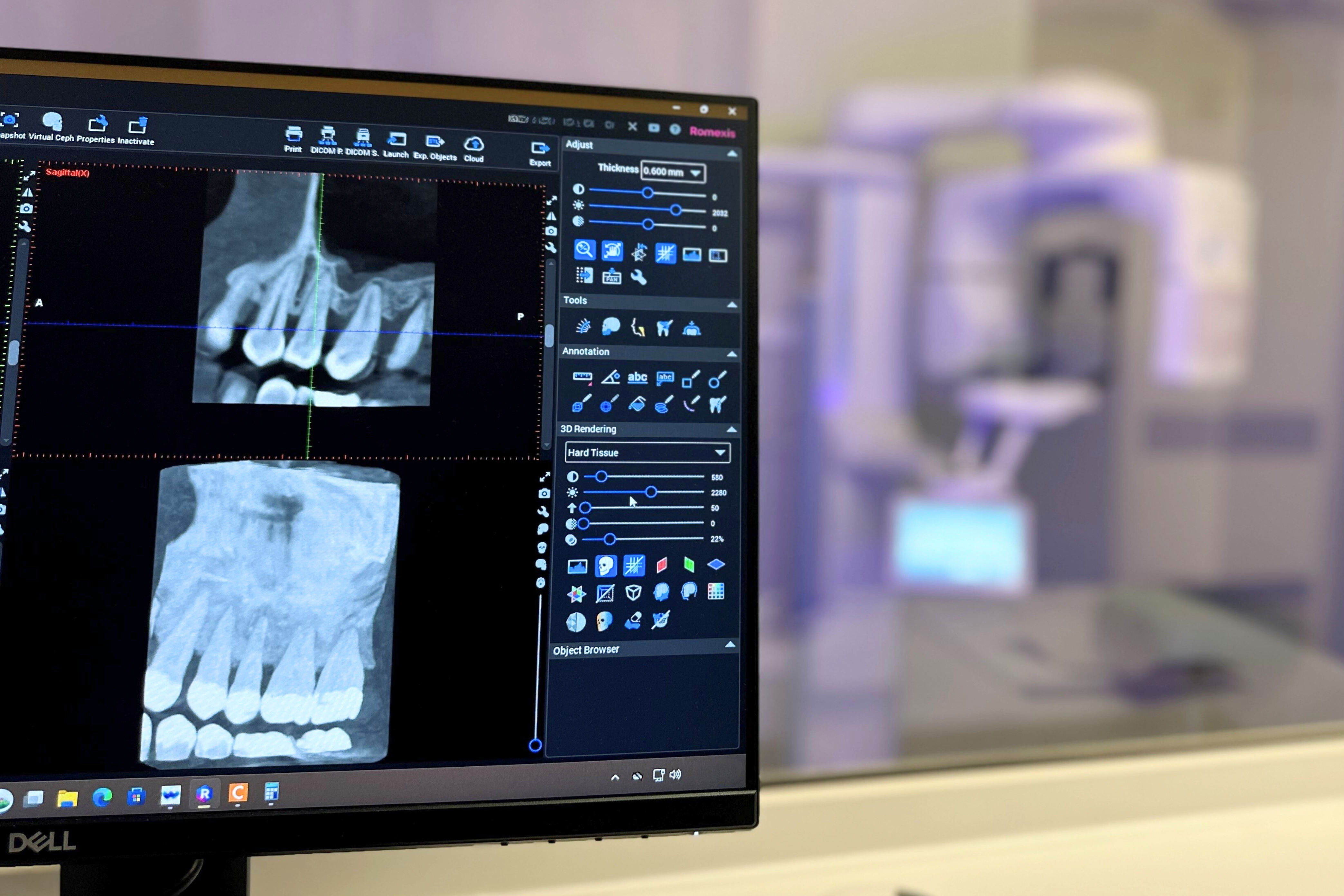 The new cone beam CT scanner in action